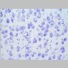 Neuronas Nissl 16.jpg